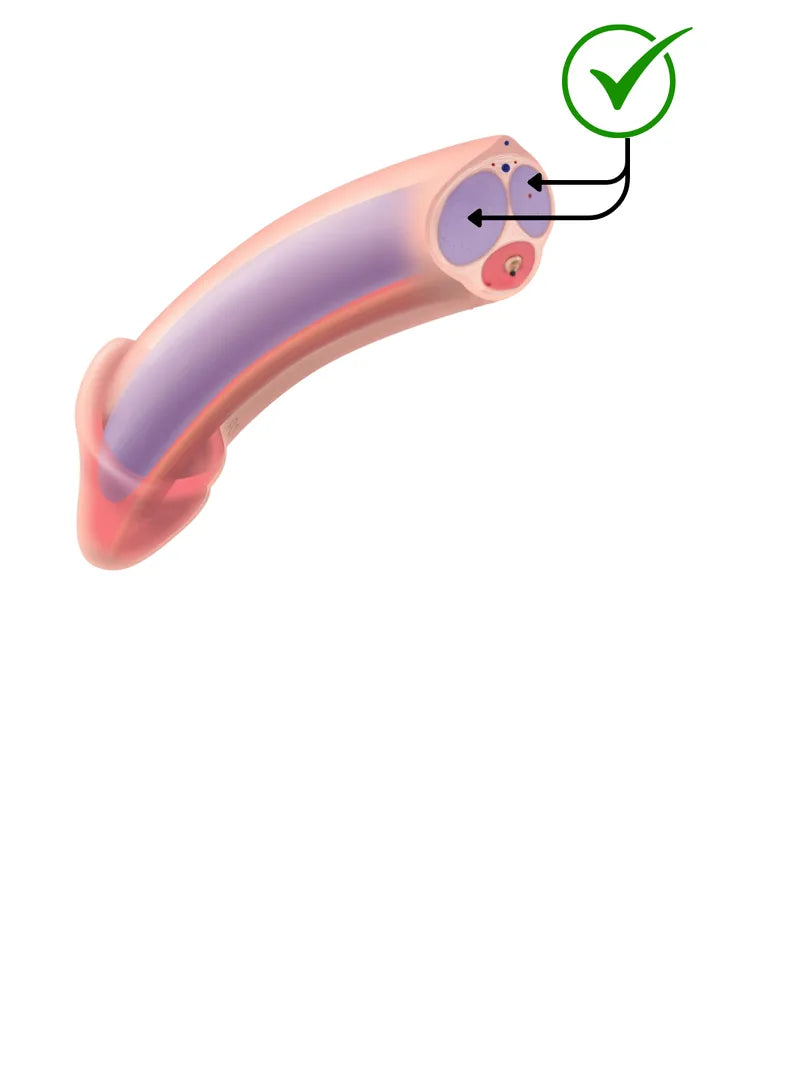 Penis Pump Edema: Why Swelling Happens